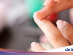 4 Perubahan Di Kuku yang Bisa Karena Itu Pertanda Gangguan, Jangan Diabaikan!