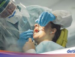 Cabut Gigi Bungsu Apakah Hingga Praktisi Medis Gigi Umum atau Spesialis Bedah Mulut?