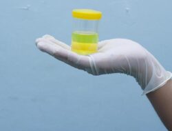 Ahli Kebugaran Ungkap Beda Busa Ke Urine yang Normal Vs Tanda Ginjal Bermasalah