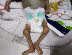 Praktisi Medis Ceritakan Ngerinya Kebugaran Warga Termasuk Anak-anak Ke Gaza yang Kelaparan Global Global