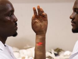 Keren, Lengan Bionik Di Nigeria Seperti Kulit Manusia