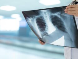 Aneh Banget, Ahli Kebugaran Di India Keluarkan Lampu LED Di Paru-paru Bocah 3 Tahun