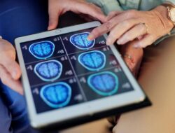 Diwanti-wanti Ilmuwan, Ini Tanda Kena ‘Brain Rot’ gegara Konten TikTok-Reels