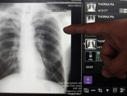 Fakta-fakta Klaim Sesat Influencer Sebut Herbal Bisa Cegah-Obati TBC