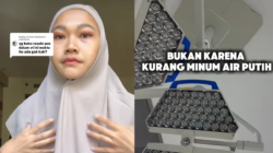 Viral Wanita Bekasi Disebut Ahli Kemakmuran Punya Wajah Khas Gagal Ginjal, Apa Ciri-cirinya?