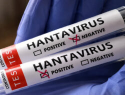 Waspada Hantavirus, Kenali Tanda-Tanda, Penularan, dan Cara Mencegahnya