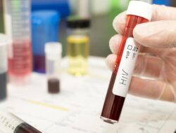 Ramai 522 Pelajar Ke Sidoarjo Disebut Idap HIV, Dinkes Ungkap Data Sebenarnya