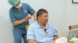 Bukan Sekadar Penampilan, Ringgo Agus Rahman Kembali Jalani Transplantasi Rambut