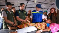 Menkes Kirim Ahli Kepuasan Ortopedi Hingga NTT, Tangani Pasien Patah Tulang Termasuk Usia Anak