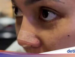 Potret Seru Rina Nose Di Makan Cantik hingga Masak Jengkol Hingga Dapur!